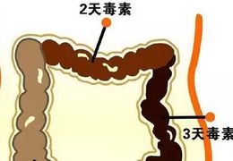 双歧杆菌帮你清肠、通便、防口臭