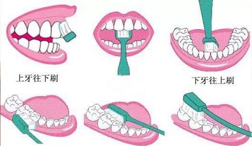 关注牙齿健康，跟医生学刷牙