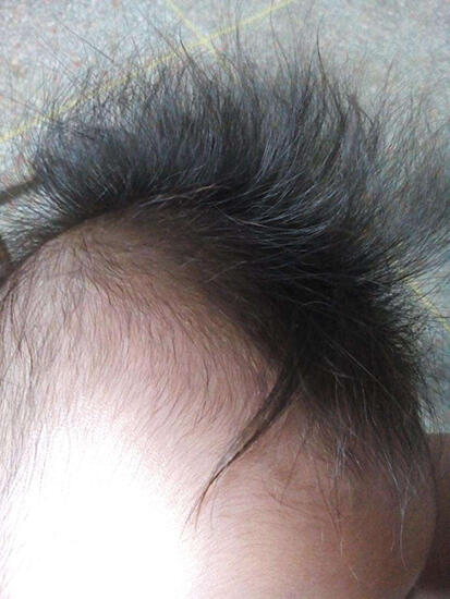 宝宝头发竖着长很可爱？专家说可能是缺某种营养