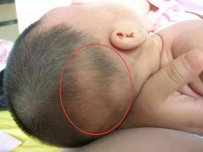 婴儿头发稀少别着急，4个办法刺激头发生长
